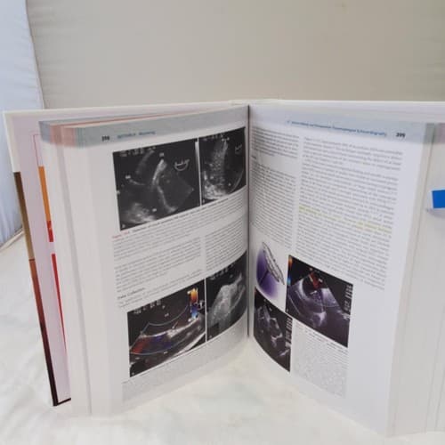 Kaplan's Cardiac Anesthesia The Echo Era Sixth Edition by Joel A. Kaplan - Thumbnail 6