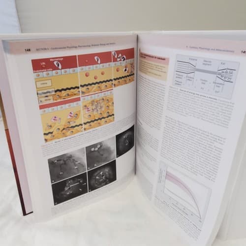 Kaplan's Cardiac Anesthesia The Echo Era Sixth Edition by Joel A. Kaplan - Thumbnail 7