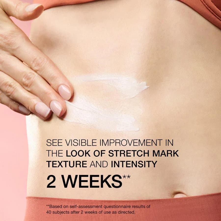 StriVectin StriVectin SD Advanced Plus Intensive Moisturizer for Wrinkles and Stretchmarks NA 1.6 Oz - Thumbnail 3