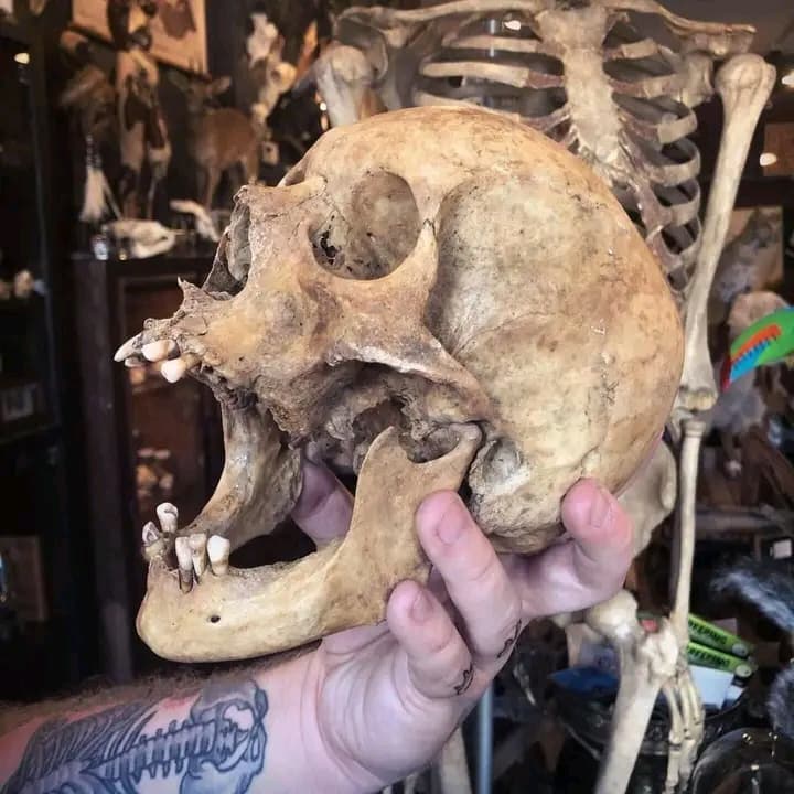 Human bones for sale - Thumbnail 4