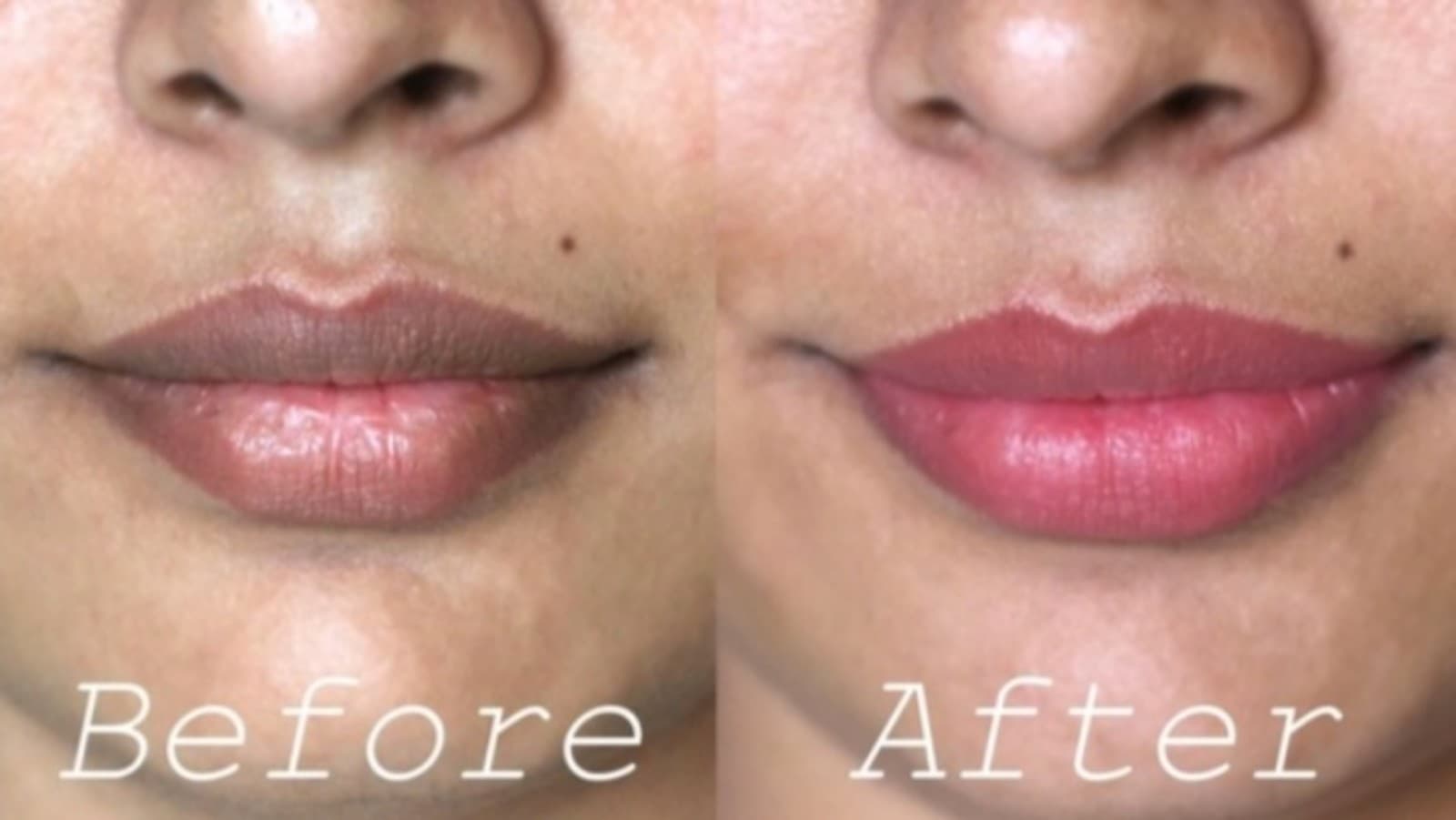 Powerful Brightening Lip Kit of 4: Lip Cream, Sugar Scrub & Scrub & Lip Gloss - Thumbnail 5