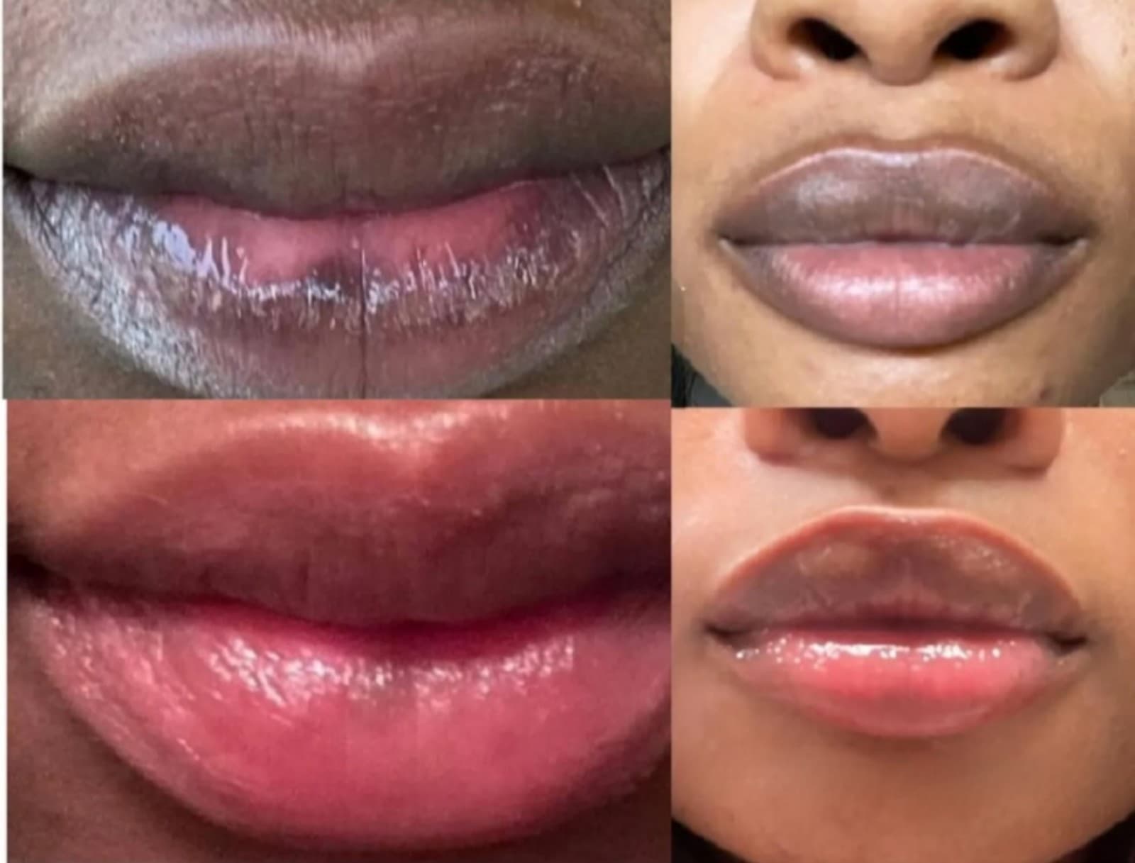 Powerful Brightening Lip Kit of 4: Lip Cream, Sugar Scrub & Scrub & Lip Gloss - Thumbnail 7