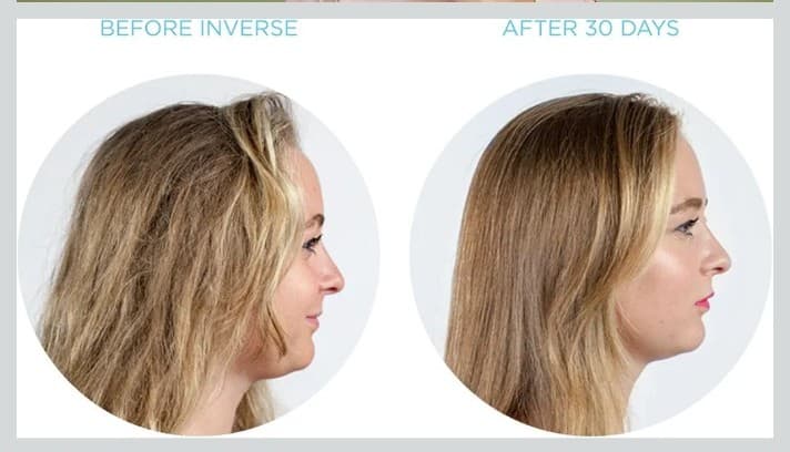 Inverse Hair Conditioning System – Repair Dry Damaged brittle hair . - Thumbnail 3