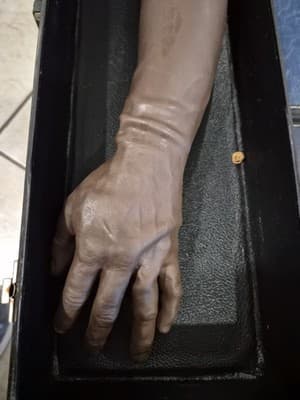 NASCO LIFE FORM MEDICAL INJECTABLE TRAINING ARM WITH CASE - Thumbnail 2