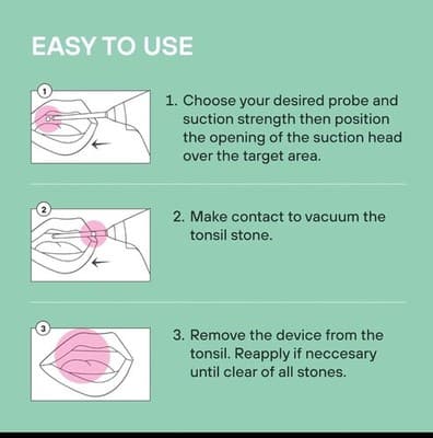 Electronic Tonsil Stone Remover Vacuum Suction LED Guidance Tool White - Thumbnail 6