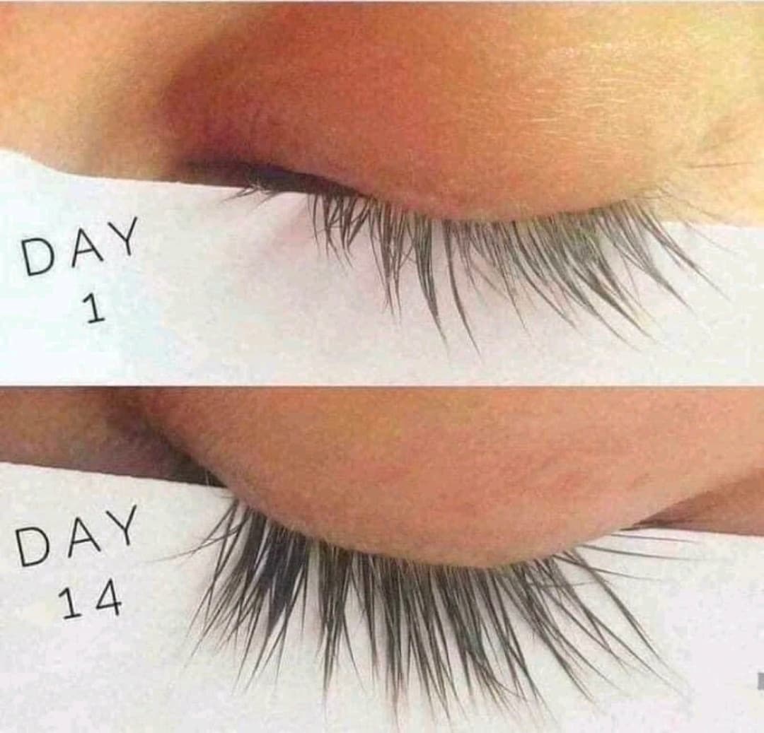 FKN Eyelash Serum 5ml for Longer Thicker Lashes - Image 1