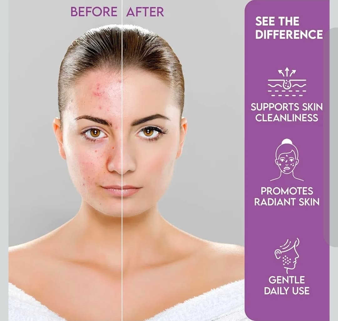 Natura Patch Hydrocolloid Acne Patches 10 Pack - Thumbnail 2