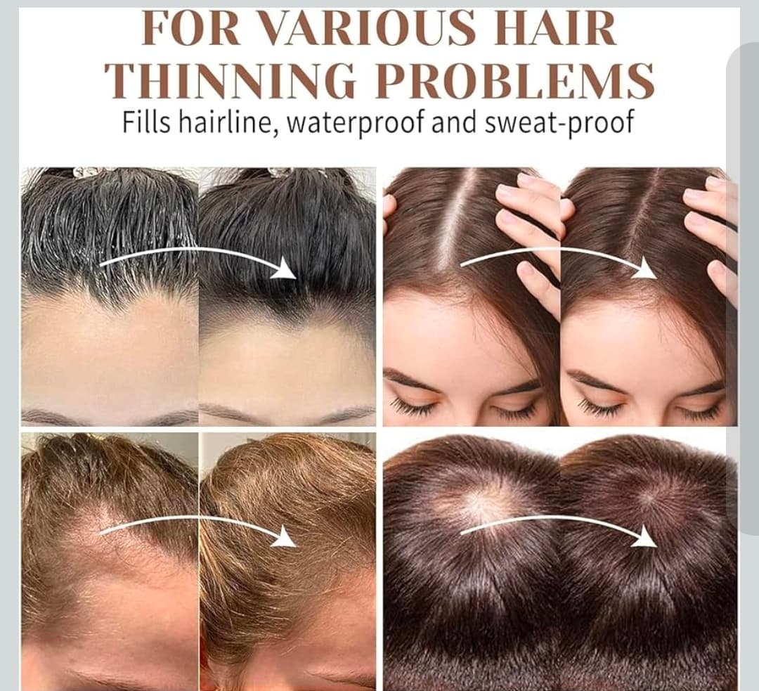 Nizo Rick Hairline Powder Root Touch-Up 4.55g Medium Brown - Thumbnail 2