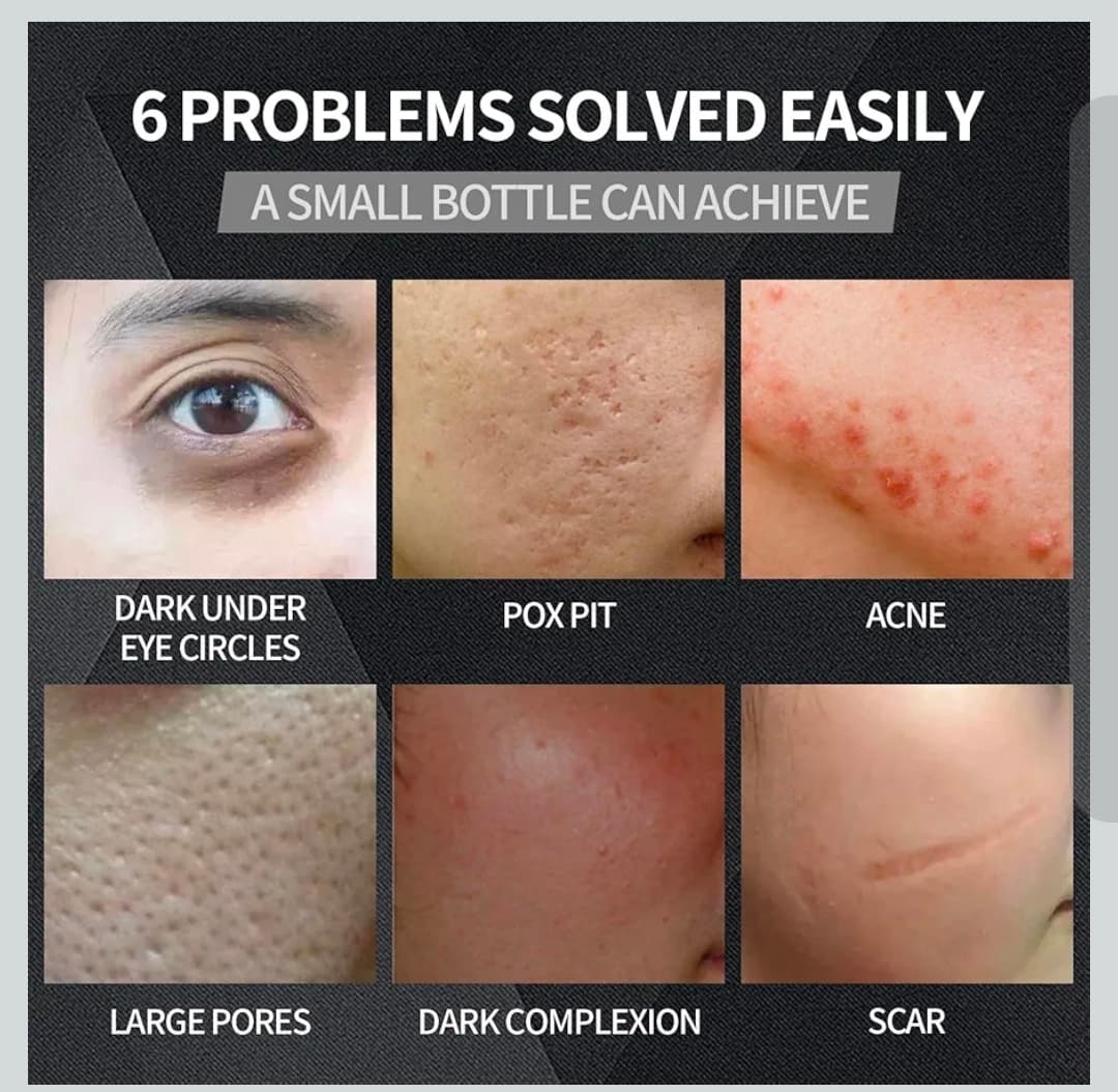 Nizo Rick Men's Tinted Moisturizer 30g Evenly Concealer Light - Thumbnail 3