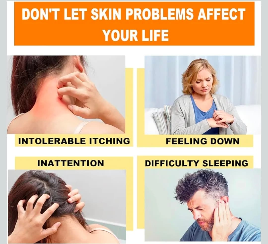 Bee Venom Care Cream 0.71 oz Skin Relief - Thumbnail 3