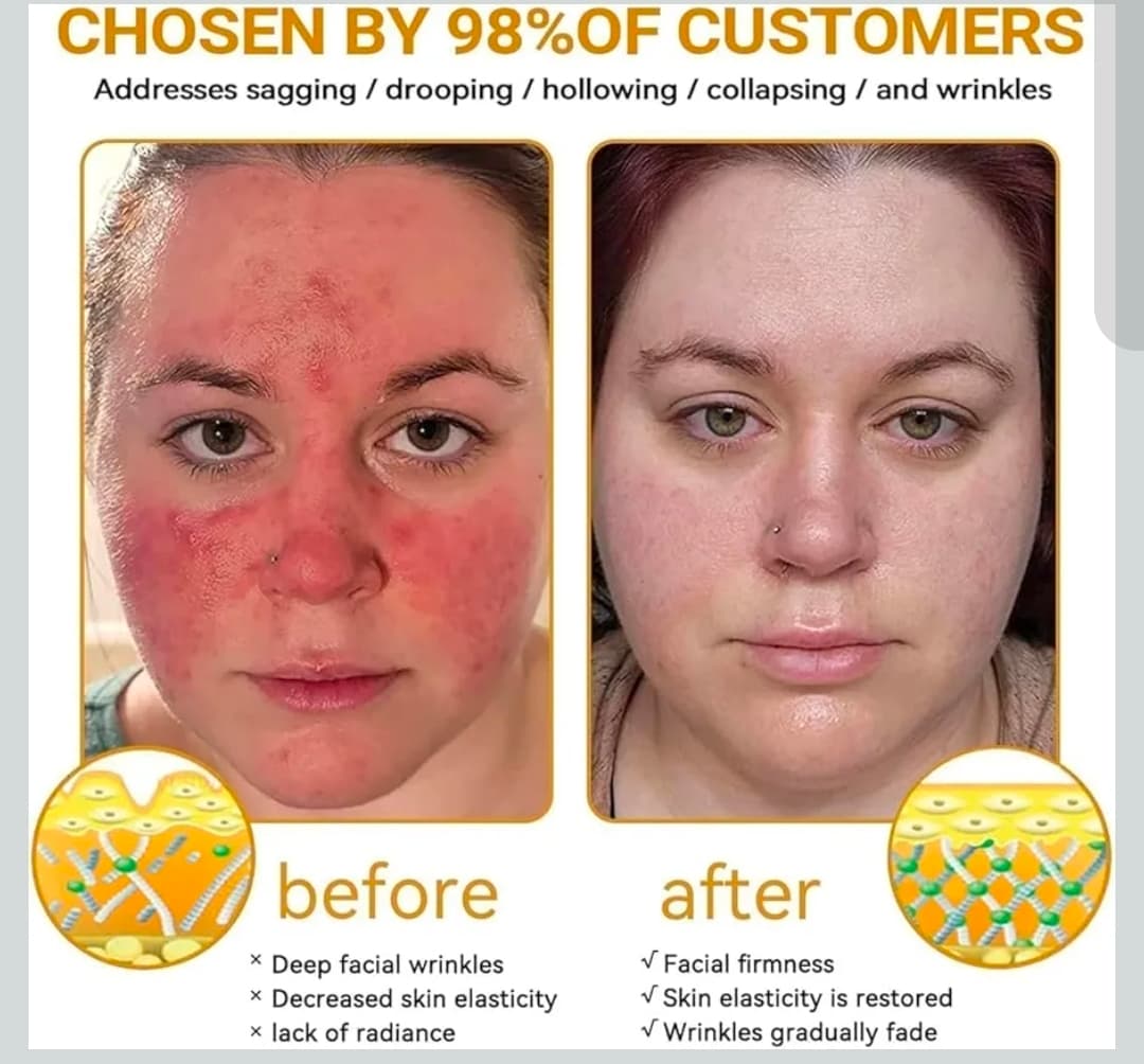 2 Packs Bee Venom Comprehensive Cream for Skin Restoration - Thumbnail 7