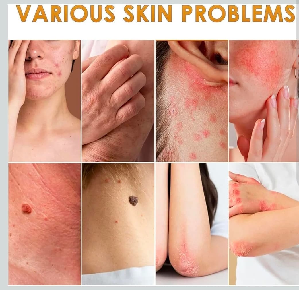 2 Packs Bee Venom Comprehensive Cream for Skin Restoration - Thumbnail 6