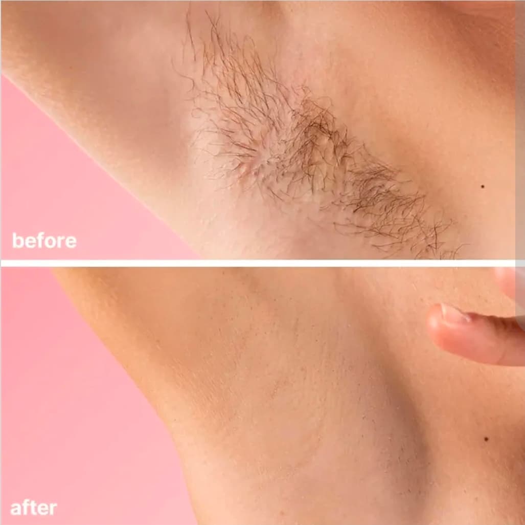 No-Shave Hair Removal Cream 150g Sensitive Skin-Friendly - Thumbnail 7