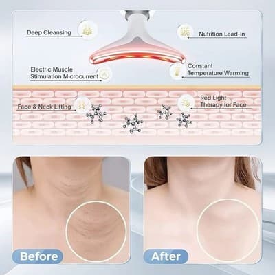 New Intense Pulsed Light, Wrinkles Reducing Instrument , ES-1081 USB Charger - Thumbnail 7