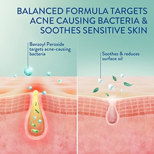 Cetaphil Gentle Clear Complexion-Clearing BPO Acne Cleanser, 4.2 OZ - Thumbnail 4