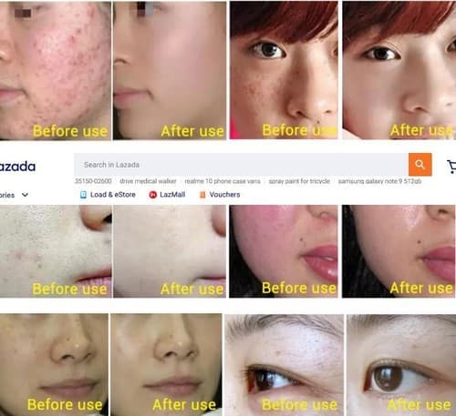 Senana Niacinamide Ampoule 7-Piece Serum Skin Whitening, Hydratting Anti-Aging - Thumbnail 8