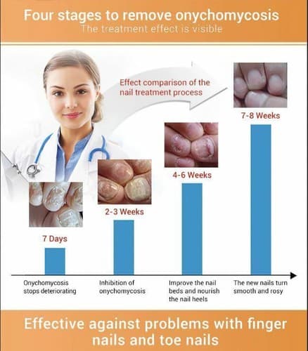 Ginger Antibacterial Fungal Nail Treatment Nail Repair Essential Oil Serum 12ml - Thumbnail 8