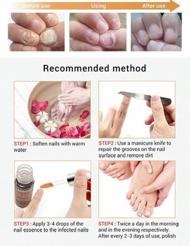 Ginger Antibacterial Fungal Nail Treatment Nail Repair Essential Oil Serum 12ml - Thumbnail 7