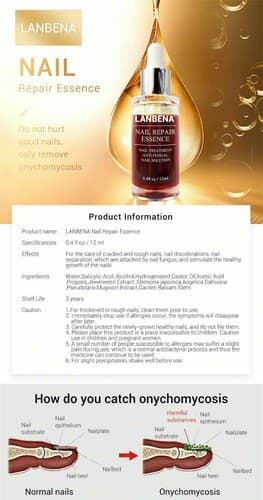 Ginger Antibacterial Fungal Nail Treatment Nail Repair Essential Oil Serum 12ml - Thumbnail 6
