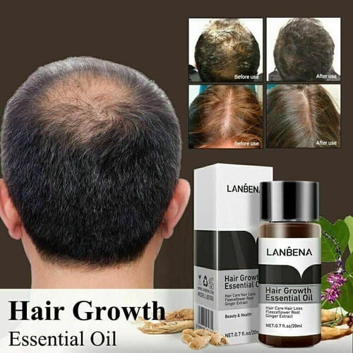 Lanbena Ginger Extract Hair Care Fast Powerful Hair Growth Essential Oil 20ml - Image 1
