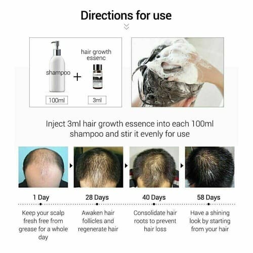 Lanbena Ginger Extract Hair Care Fast Powerful Hair Growth Essential Oil 20ml - Thumbnail 2