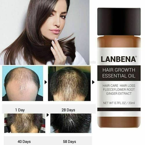 2 Pack Powerful Natural Hair Loss Treatment Fast Hair Growth Essential Oil 20ml - Thumbnail 2