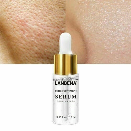 2 pack Pore Shrinkage Remove Blackhead Whitehead Acne Deep Cleansing Whitening - Thumbnail 6