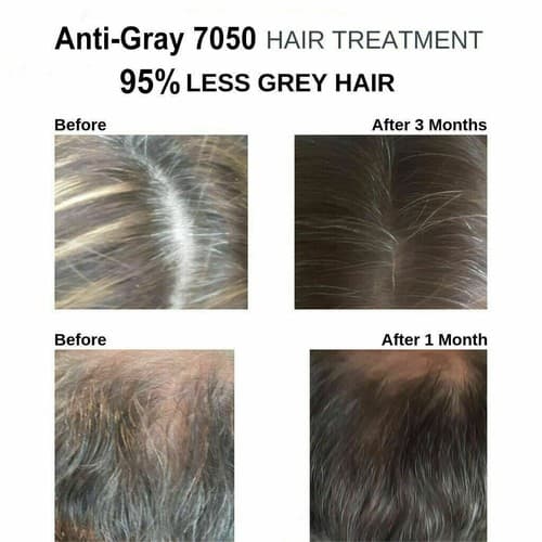 3 Pack Anti Gray 7050 Hair Saw Palmetto Catalase Max Strength Dietary Supplement - Thumbnail 4