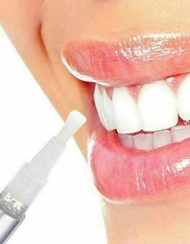 3 Pcs Ultimate Strength Tooth Bleaching Gel Mint Flavor Teeth Whitening Pen - Thumbnail 3