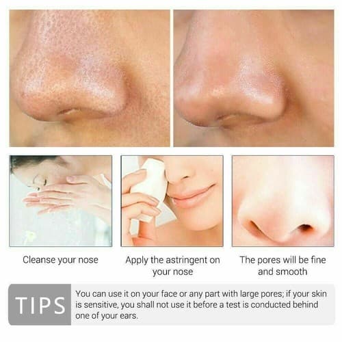Pore Shrinkage Liquid Remove Blackhead Whitehead Acne Deep Cleansing Whitening - Thumbnail 4