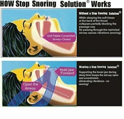 Anti Snoring Sleep Apnea Jaw Solution Snore Stop Belt Cpap Blue Chin Strap - Thumbnail 5