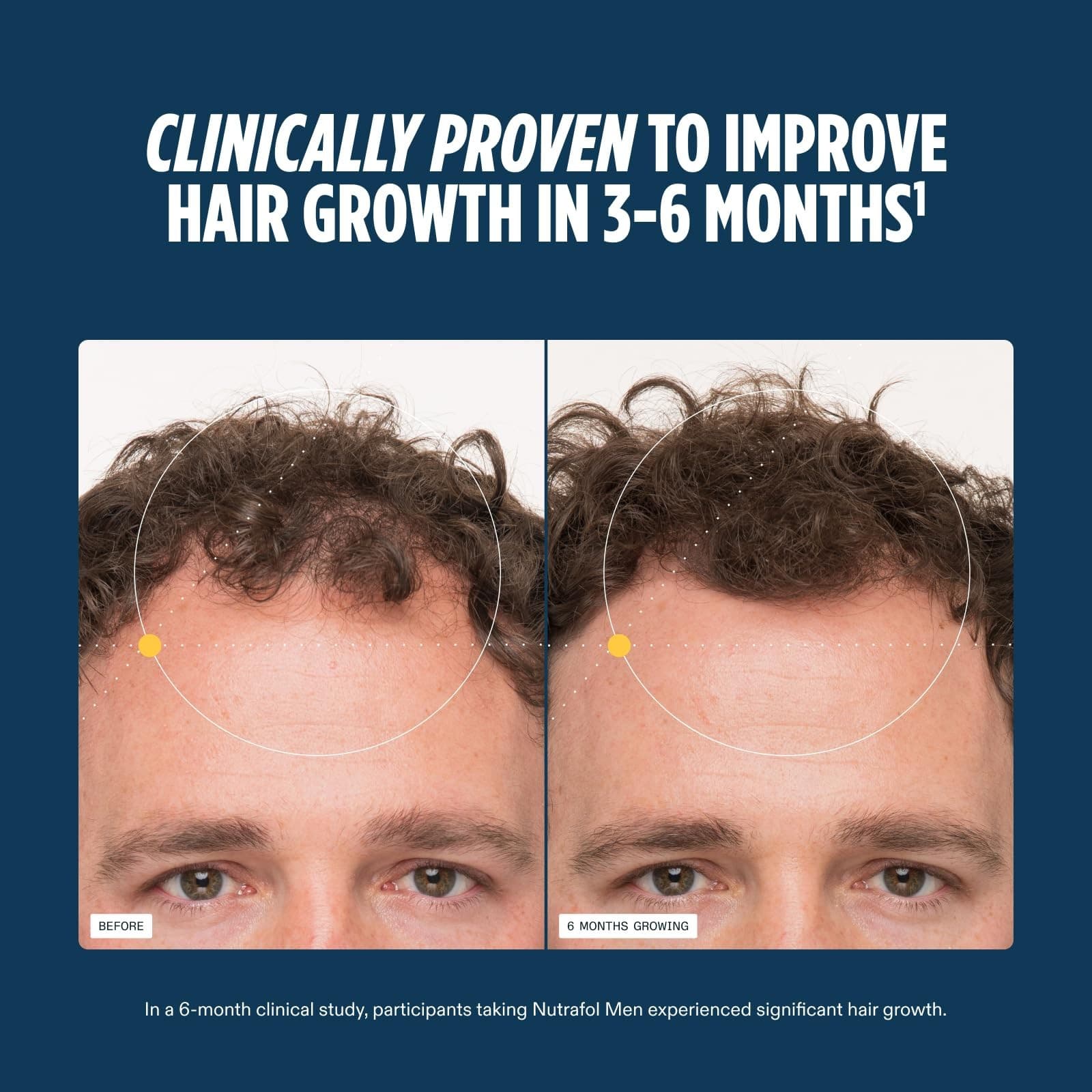 NUTRAFOL Men’s AUTHENTIC Hair Growth 2 Bottle 120 Pill each 2month supply - Thumbnail 7