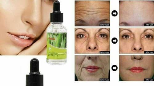 Aloe Vera Facial Serum – Natural Acne Healing & Soothing Skin Repair - Thumbnail 9