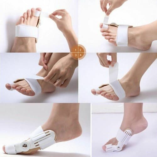Hallux Valgus Correction Bunion Splint Big Toe Straightener Foot Pain Relief - Thumbnail 3