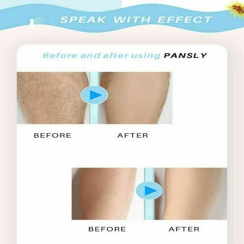Herbal Gentle Hair Removal Spray Repair Nourish Permanent Hair Growth Inhibitor - Thumbnail 10