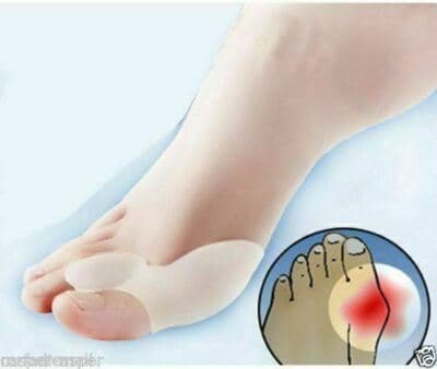 12 Pcs Gel Big Toe Bunion Guards Toe Spreaders Pain Relief Crooked Overlapping - Thumbnail 6