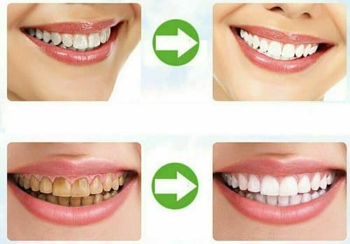 5 Pcs Organic Coconut Activated Charcoal Whitener Natural Teeth Whitening Powder - Thumbnail 4