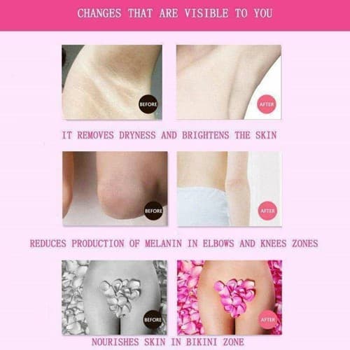 6 PK Dark Skin Bleaching Cream Whitening Lightening for Face&Body, Max Strength - Thumbnail 3