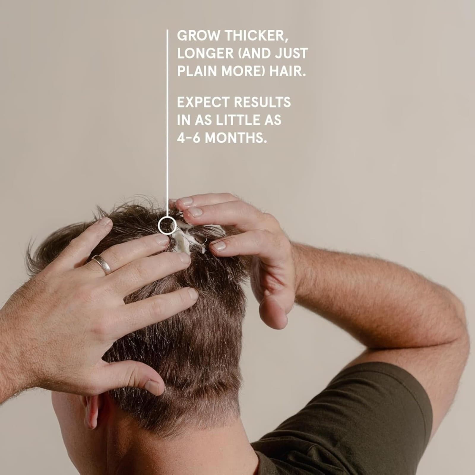 Keeps Minoxidil Hair Loss Aerosol Foam 5% Hair Growth Treatment 6 Month Supply - Thumbnail 5