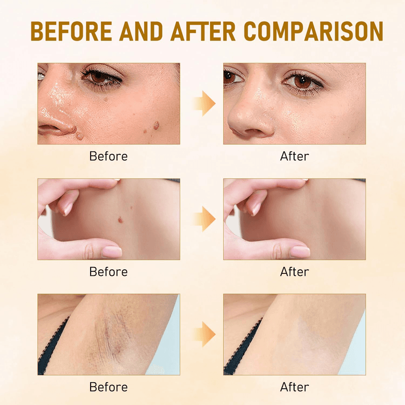 2PCS Bee Venom All-In-One Cream Skin Treatment 2025 Professional Bee Venom Cream - Thumbnail 4