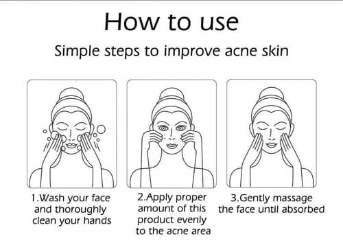 Face Skin Care Acne Treatment Removal Cream Spots Scar Blemish Marks - Thumbnail 6