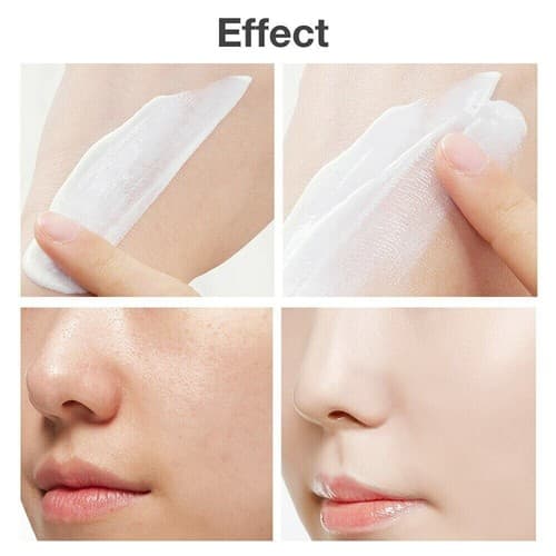 Face Skin Care Acne Treatment Removal Cream Spots Scar Blemish Marks - Thumbnail 8