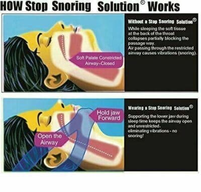 Snore Stop Belt Sleep Apnea Jaw Solution Anti Snoring Cpap Blue Chin Strap - Thumbnail 5