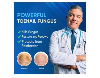 Tobcharm Fungal Nail Renewal Maximum Strength Treatment 0.5 fl oz 2 Bottles - Thumbnail 4