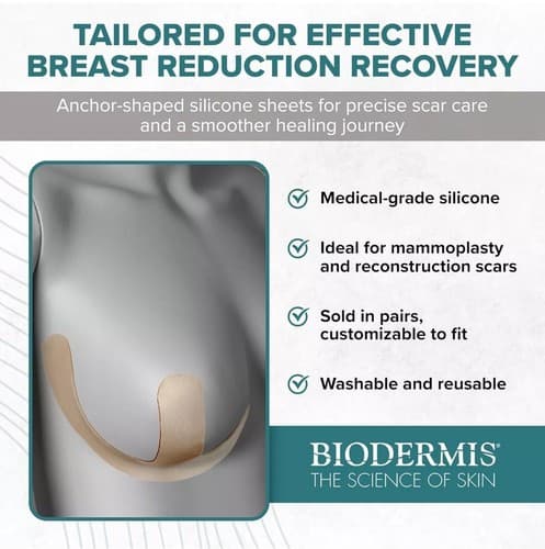 Epi-Derm Silicone Scar Tape - Anchor Design for Breast Reduction Recovery - Thumbnail 2