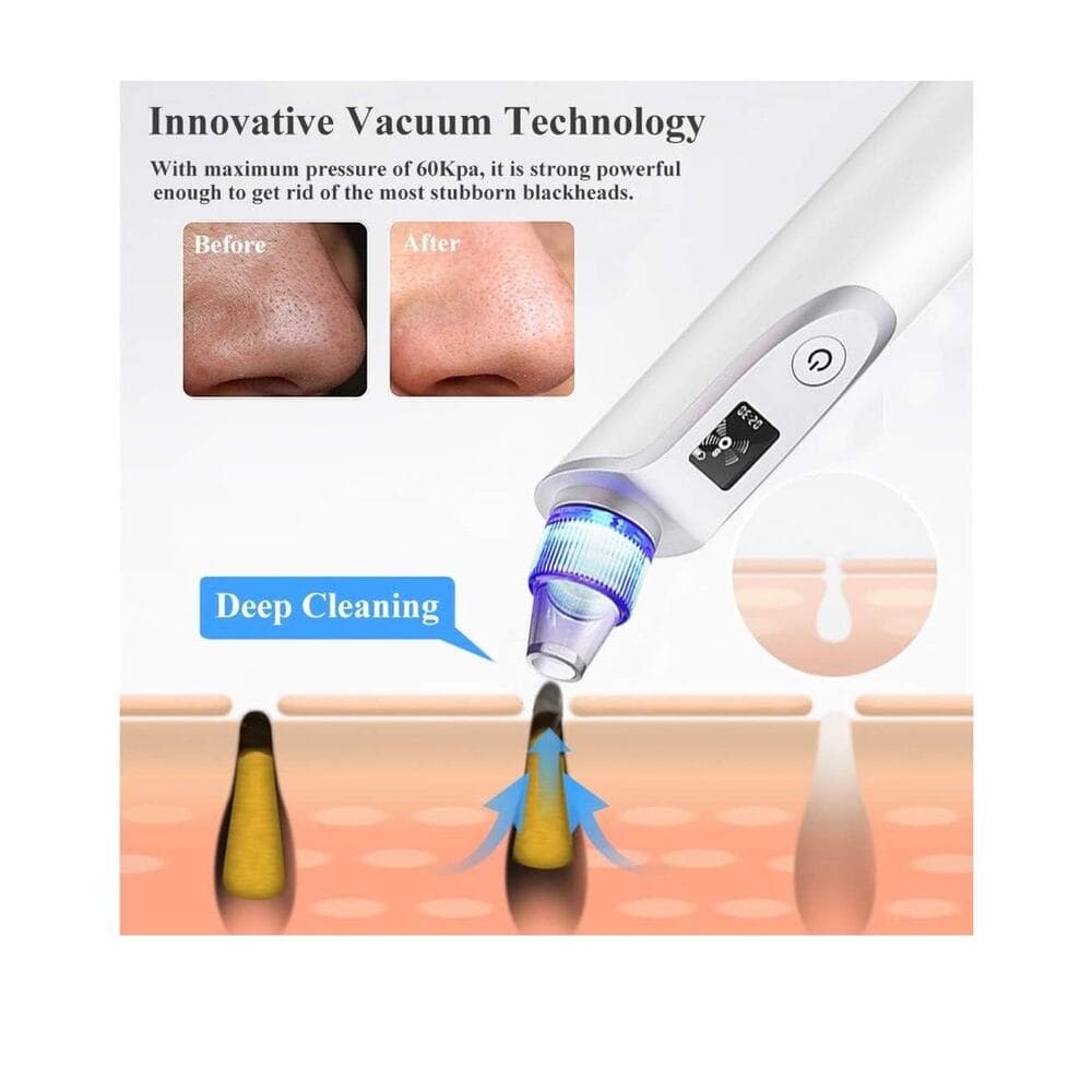 GOODSKY Blackhead Remover Vacuum, Electric Comedo Suction Removal Tool - Thumbnail 2