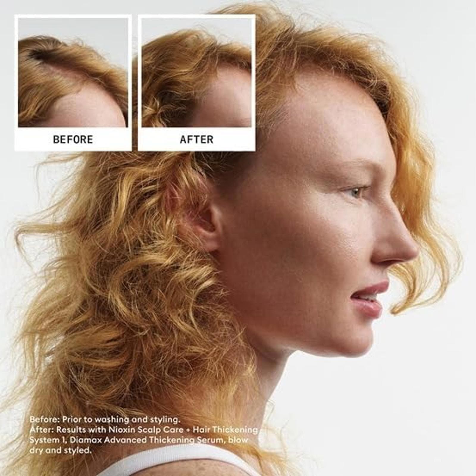 ** Open Box - Nioxin System 1 Scalp + Hair Thickening Kit (300ml/300 ml/100ml) - Thumbnail 2