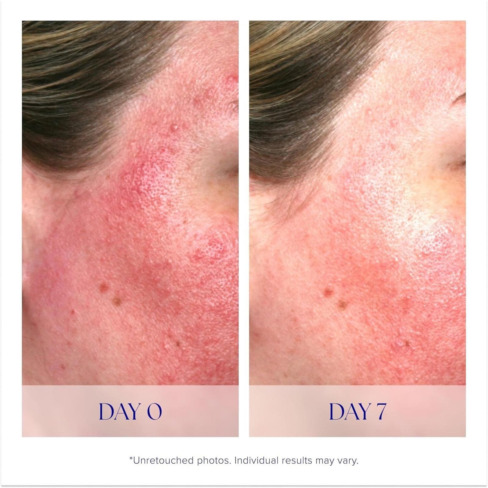 One time used - iS Clinical Pro-Heal Serum Advance + 1 oz - Thumbnail 2