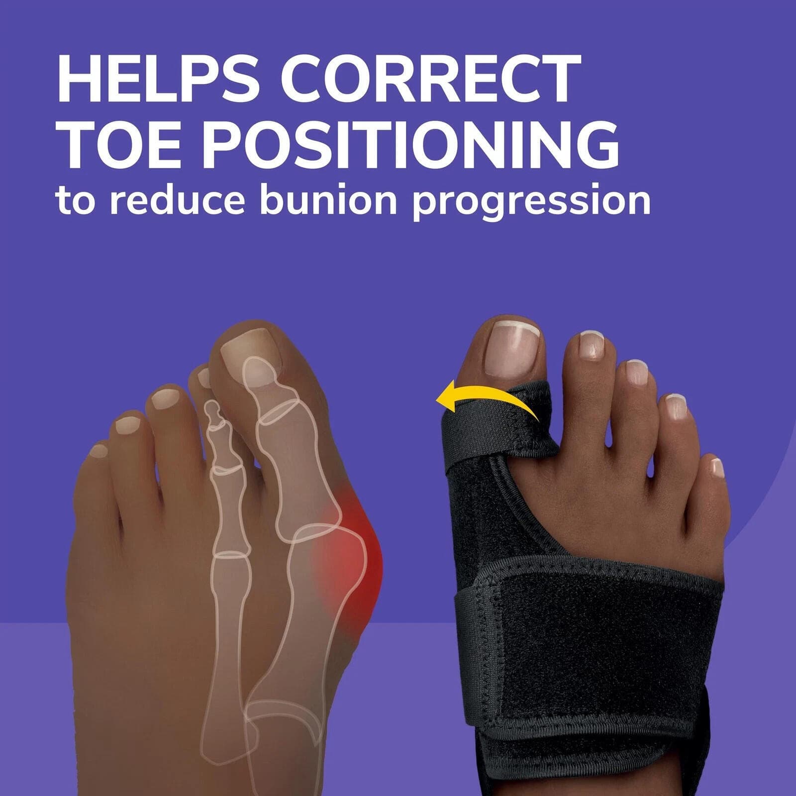 One time used- Dr. Scholl's BUNION RELIEF & TOE CORRECTOR (no retail box) - Thumbnail 3
