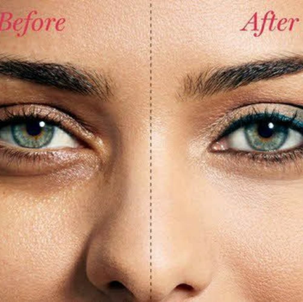 Dark Circle Remover- Get rid of Puffy Eyes!! - Thumbnail 4